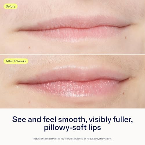 Skinfix Triple Lipid Lip Treatment - 0.27 Oz - Hydrating Volumizing Balm - Visibly Smooths Fine Lines - Fragrance - Vegan Cruelty