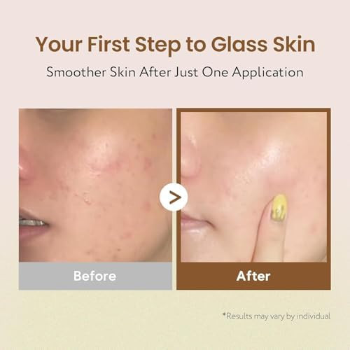 Soonding Coconut Rice Milk Toner Calming Hydration Smooth Skin Texture And Strengthen Skin Barrier With Rice Panthenol Ceramide Aha Fragrance- Korean Skin Care (150Ml/ 5.07 Fl Oz)