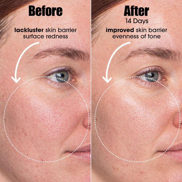 Sunday Riley A.I. Adaptive Retinoid Serum For Blemish Prone Skin