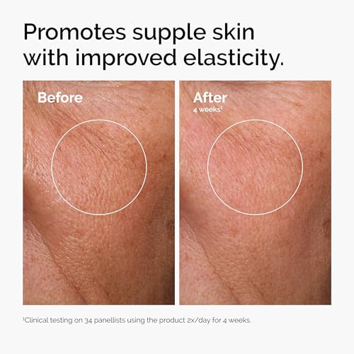 The Ordinary Serum Favorites Set Hyaluronic Acid 2% + B5 Niacinamide 10% + Zinc 1% Caffeine Solution 5% Eye And Face Serums For Hydrating Brightening & Pore-Minimizing Skin Care