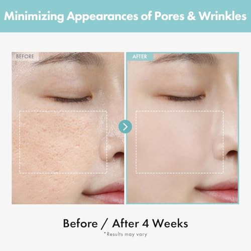 Tosowoong Pore Refiner Cream Pore Minimizer With Aha - Glycolic Acid And Lactic Acid Oil Control Face Moisturizer For Oily Skin Texture Smoothing For Fine Lines Korean Skincare 50G / 1.76 Oz