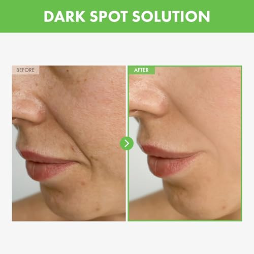 Tosowoong Kakadu Plum Blemish Cream Dark Spot Remover For Face Cream Kakadu Plum 600000Ppm Niacinamide Adenosine Betaine Dark Spot Corrector Vitamin C Korean Skin Care 50G 1.76 Oz
