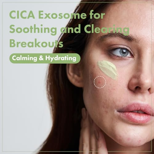 Tosowoong Exosome Cica Face Cream - Daily Soothing Moisturizer For Breakouts And Irritated Skin Fast-Acting Lightweight Korean Skincare For Redness And Blemish-Prone Skin 50Ml / 1.69 Fl. Oz
