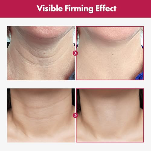 Tosowoong Collagen Necktox Cream With Collagen And Hyaluronic Acid For Neck Firming Anti-Aging Wrinkles And Tightening Korean Skin Care 50Ml 1.69 Fl. Oz