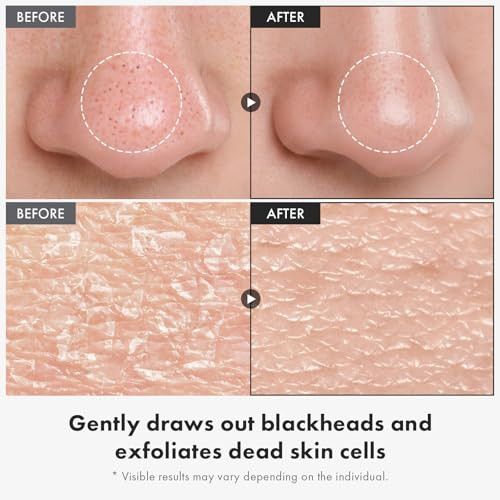 Tosowoong Black Rice Peeling Ampoule 75% Black Rice Exfoliant Dead Skin Remover Face Body Scrub Blackheads Pore Cleaner Kojic Acid Arbutin For Discoloration Korean Skincare 85Ml / 2.87 Fl. Oz