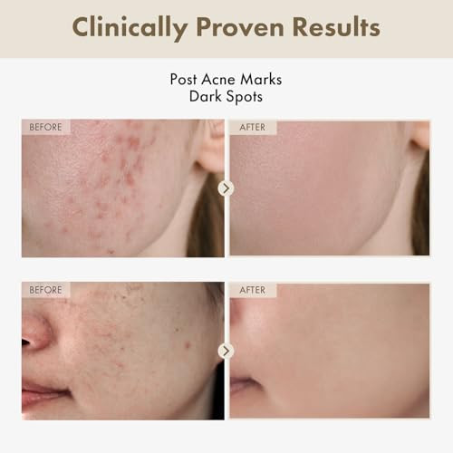 Tosowoong Alpha Arbutin 2% Rice Serum Rice 746074Ppm Alpha-Arbutin 20000Ppm Glow Glass Skin Pigmentation Acne Marks Dark Spots Even Skin Tone Hydrating Korean Skin Care 33Ml / 1.11 Fl.Oz