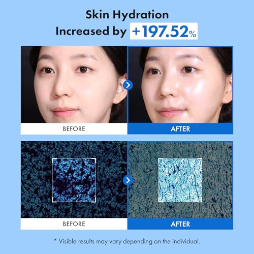 Tosowoong 8 Hyaluron Skin Booster Serum For Face With Niacinamide Glycerin Panthenol Hydration Boosting Facial Essence Plumper Skin Glass Skin All Skin Types Korean Skincare 150Ml/5.07 Fl. Oz
