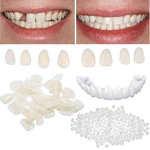 Brige Tooth Repair Kit For Fixing The Missing Chipped And Broken Tooth Gap Temporary Replacement Thermal Beads And Fake Teeth Brace Mold
