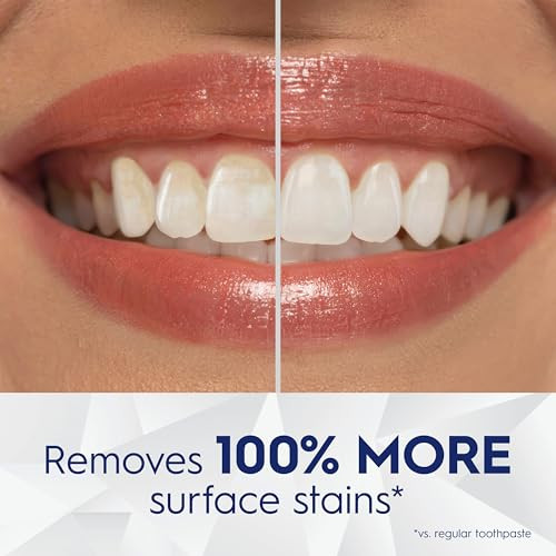 Crest 3D White Brilliance Bright Mint Teeth Whitening Toothpaste 4.3 Oz Pack Of 3 100 More Surface Stain Removal 24 Hour Active Stain Prevention Whiter Teeth In 3 Days