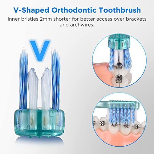 Fregum V-Shaped Orthodontic Toothbrush For Braces & End Tuft Toothbrush For Orthodontic
