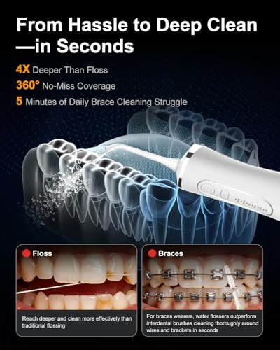 Mysmile Lp211 Water Flosser Cordless For Teeth 5 Modes Portable Oral Irrigator 260Ml Water Dental Picks For Sensitive Teeth Cleaning Ipx7 Travel Rechargeable Water Flossing &2 Teeth Wipes
