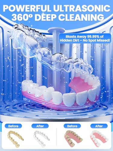 Nicwell Dental Ultrasonic Retainer Cleaner Machine Nicwell 200Ml Dental Cleaning Pod For Denture Mouth Guard Night Guard Braces Tray Aligner 45Khz Cleaner With Protection Design & Digital Timer