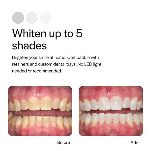 Opalescence 35 Cp Mint - Gel Syringes Teeth Whitening - Refill Kit (4 Syringes) Carbamide Peroxide Gel. Made By Ultradent. Tooth Whitening Refill Syringes With Toothbrush. 5197-2Tb