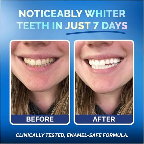 Pop On Veneers Teeth Whitening Strips For Sensitive Teeth And Gums - Peroxide Free And Enamel Safe With Coconut Oil For Gentle And Whiter Teeth - 7-Day Treatment White Strips With Non-Slip And Dry-Strip Technology