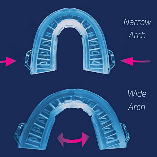 Smartguard Anti Snore Device. New Customizable Snore Reducing Mouthpiece Reduce Snoring Aid For Men And Women Most Comfortable And Adjustable Oral Appliance - Holds Jaw Forward To Open Airway