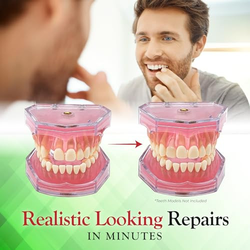 Smile Fix Smilefix Basic Dental Repair - For Missing Or Damaged Teeth - Fix Gaps Missing Teeth Spaces Broken Tooth Repairs - Fast & Easy - Confident Smiles - Bf Products - Durable Compound