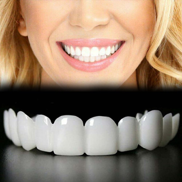 Sunnydeer Temporary Adjustable Smile Support - 2 Pairs Comfortable & Secure Top & Bottom Included (1)