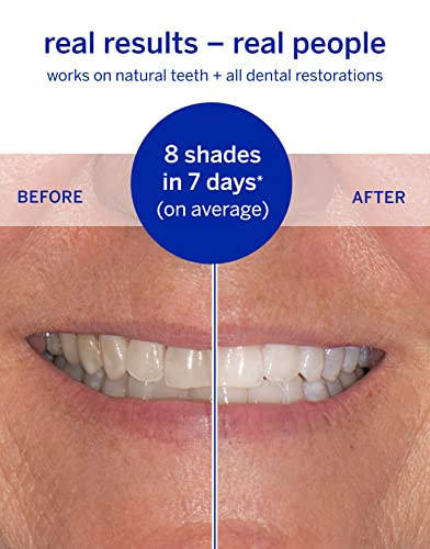Whitening Strips Superstrips By Supersmile Professional Teeth Whitening Strips Enamel Safe Teeth Whitener For Sensitive Teeth
