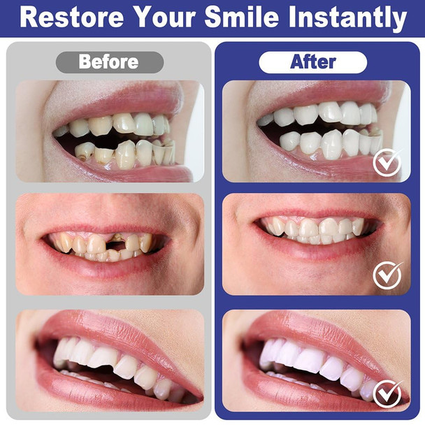 Three Wood Temporary Tooth Provisional Kit - Diy Heat Beads For Missing Or Broken Teeth Dental Restoration & Replacement