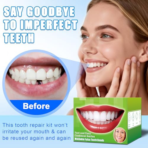 Xlmcwt Moldable False Teeth Beads - Temporary Tooth Repair Kit Fix Broken Chipped Teeth Cavity Temporary Fillings Missing Tooth Gaps & Loose Dentures Within Minutes At Home