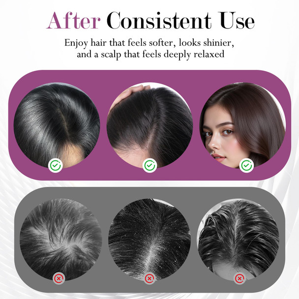 Caelgrata 3-In-1 Rechargeable Scalp Massager Hair Growth Oil Applicator, Gentle Scratching & Kneading, Ipx7 Waterproof, Electric Head Massage Tool For Home Spa, Portable Scalp Brush For All Hair Types