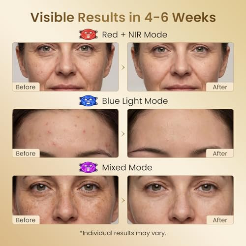 Toyxe Red Light Therapy For Face, Wireless Led Face Glow Mask With 850Nm Near-Infrared Red Light (Nir) Therapy Device, Rechargeable Portable Design For Home & Travel (White)