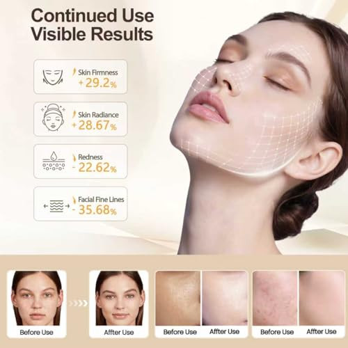 Yurui Teng Red Light Therapy For Face 7 -Color Light Modes '3-In-1 Fusion Led Beads 1200Mah Red Light Therapy Face Mask With Timer Suitable For Home Use Brighten And Tighten Skin Tone (Black)