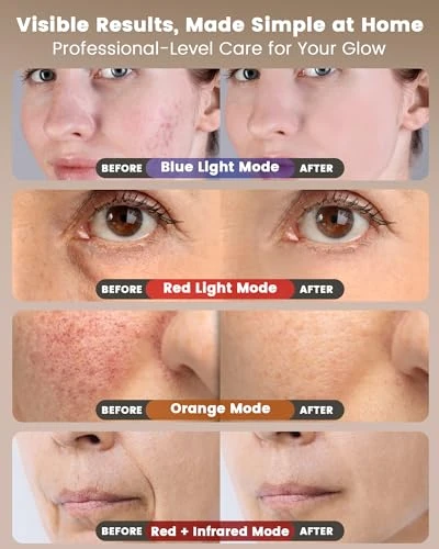 Dermita Red Light Therapy For Face Wireless With 400 Leds 360 Led Face Mask Light Therapy With 4 Modes & Near-Infrared 2000Mah Rechargeable Led Face Mask With Eye Protection For Anti-Aging & Radiant Glow