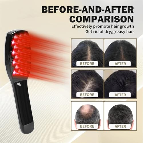 Tkcsoi Scalp Massager, Electric Scalp Massage Brush, Hair Massage Brush, Electrichead Scratcher, Masssage Comb With Soft Rubber.