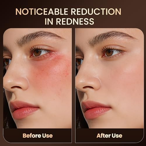 Memtim Red Light Therapy Mask For Face 4 Modes Cordless Led Face Mask Light Therapy With 2000Mah Rechargeable Remote Led Face Mask At Home& Travel
