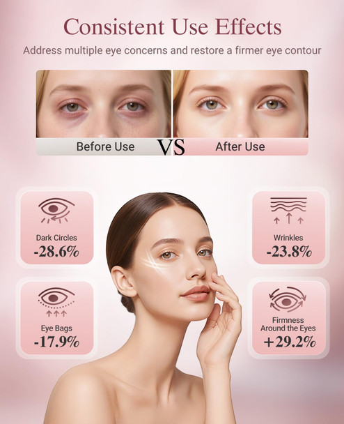 Lanieney Red Light Therapy For Eyes, Wireless Under-Eye Red Light Therapy Mask With Timing Function, 3 Modes With Near-Infrared For Eyes Bags, Dark Circles, Fine Lines, Rechargeable Home Skincare Eye Mask,Pink