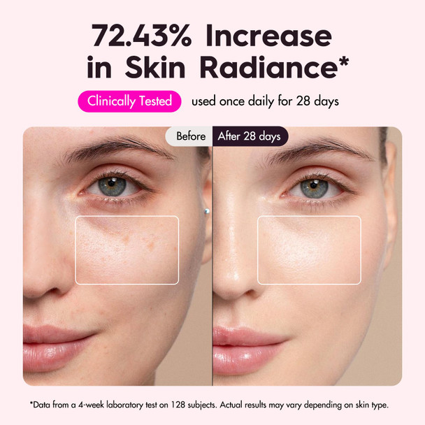 Mlriyl Red Light Therapy Mask For Face, 7-In-1 Led Face Mask Light Therapy With 432 Leds & 850Nm Nir, 3600Mah Rechargeable, Adjustable Brightness, Timer, Full Face Coverage For Flawless Glowing Skin