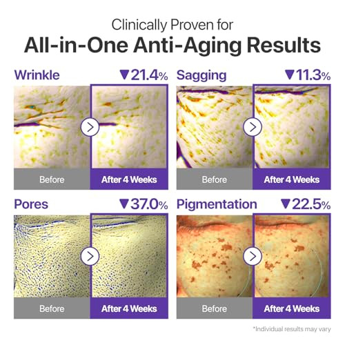 Numbuzin No.9 Nad+ Retinal Volumetox Eye Cream Anti-Aging Treat For Wrinkles Fine Lines Dark Circles & Dark Spots Gentle Retinal Formula With Peptides & Niacinamide 0.67 Fl. Oz.