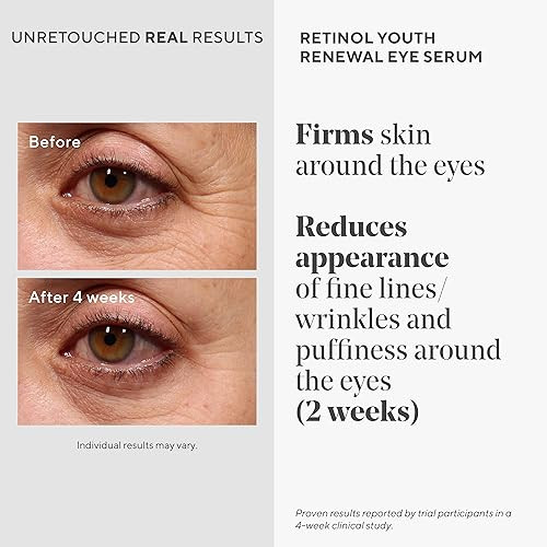 Murad Retinol Youth Renewal Eye Serum - Retinol Eye Serum Visibly Improves Undereye Puffiness Dark Circles And Reduces The Appearance Of Fine Lines Gentle Enough For Nightly Use - 0.5 Oz