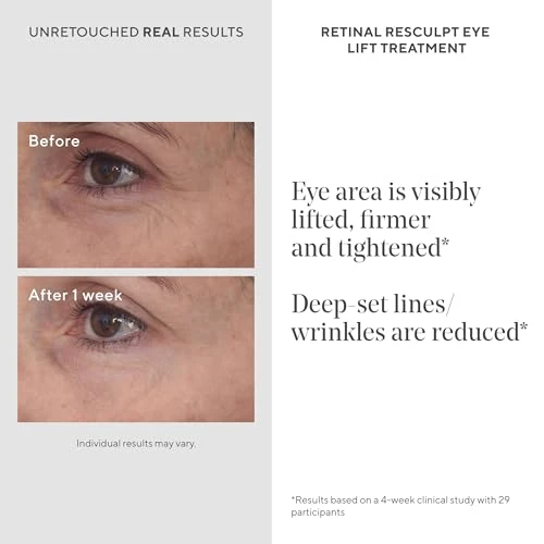 Murad Retinal Resculpt Eye Lift Treat - Age-Defying Eye Cream With Encapsulated Retinal Gentian Root & Oat-Firming Film For Youthful Eyes - Tightens Droopy Lids & Under-Eye Bags - 0.5 Fl Oz