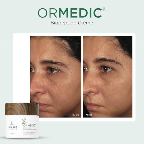 Image Skincare Ormedic Biopeptide Cr Me Balancing Face Moisturizer With Shea Butter Hyaluronic Acid And Organic Plant Oils 2Oz