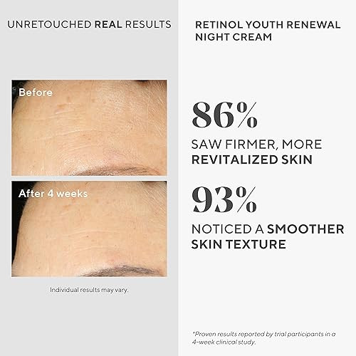 Murad Retinol Youth Renewal Night Cream - Anti-Aging Moisturizer With Retinol Tri-Active Technology And Niacinamide Gently Fights Wrinkles And Fine Lines Boosts Radiance And Firms Skin - 1.7 Fl Oz