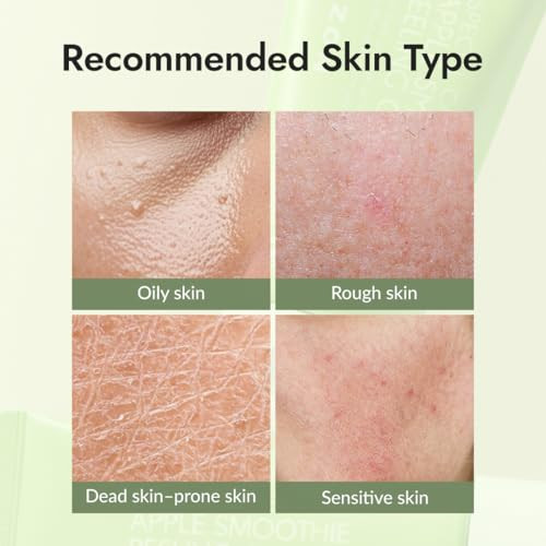 Mizon Apple Smoothie Peeling Gel For Smooth Glowing Skin Deep Cleansing And Gentle Exfoliation With Natural Elasticity For Face (120Ml 4.1 Fl Oz)