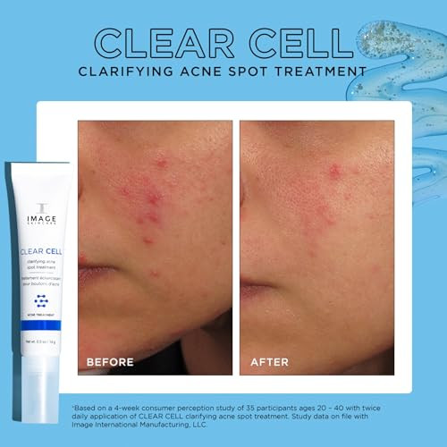 Image Skincare Clear Cell Clarifying Acne Spot Treat With Salicylic Acid Targets Existing Acne Blemishes While Preventing New Blemishes From Forming 0.5 Oz