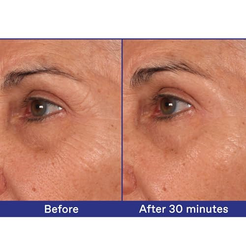 Korres White Pine Meno-Reverse Deep Wrinkle & Age Spot Serum Daily Post-Menopausal Serum With White Pine Extract Peptide Blend & Greek Yoghurt Proteins 1.0 Fl Oz