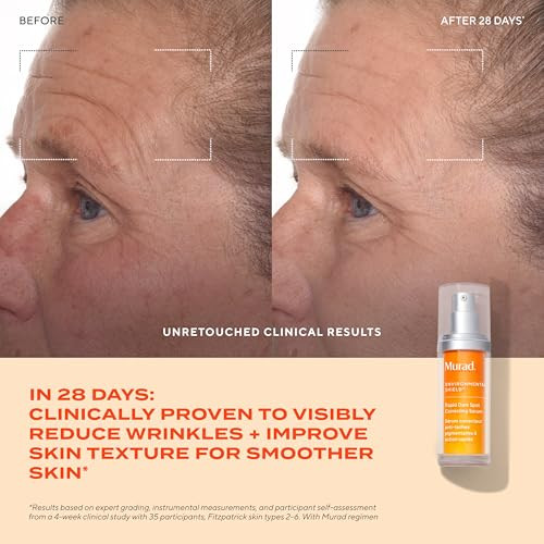 Murad Rapid Dark Spot Correcting Serum - Advanced Anti-Aging Formula With Patented Resorcinol Technology Tranexamic And Glycolic Acids For Hyperpigation Dark Spots And Dull Skin - 1 Fl Oz