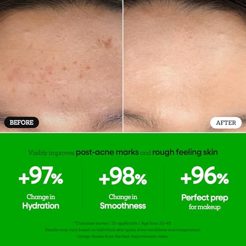 Nature Republic The First Peptide Boosting Serum Niacinamide Adenosine Hydrating & Firming Facial Serum For Fine Lines & Pores Korean Skincare / 150Ml 5.07 Fl Oz