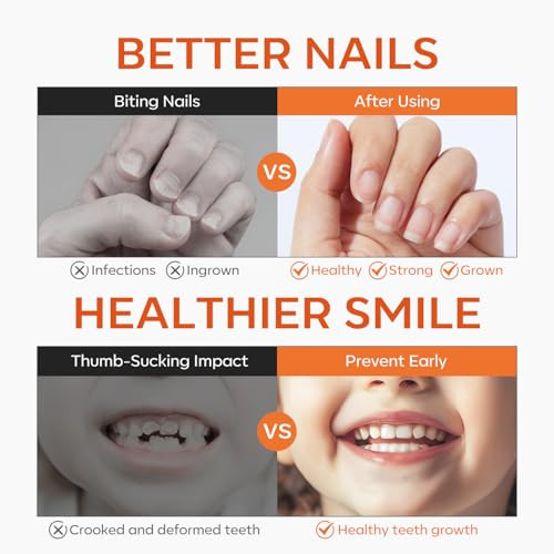 Modelones Nail Biting Prevention For Kids Upgraded Thumb Sucking Deterrent Quick Dry Bitter No Bite Nail Polish Stop Biting Nail Polish 12 Ml 0.41Fl Oz