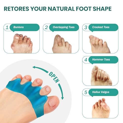 Welnove Silicone Toe Separators For Correct Bunion - Toe Spacers For Feet Men - Hammertoe Straighteners For Women Yoga Practice Foot Alignment Fsa Or Hsa Eligible 8 Pack