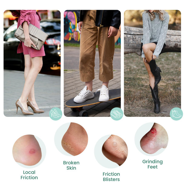 Welnove Blister Prevention Patches Moleskin For Shoes (Glossy Low Friction Film Not Traditional Padded Moleskin) Protects Tender Areas From Friction  Total 1.79 Sq Ft 25 Sheets