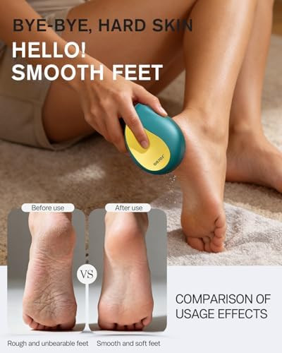 BEZOX Glass Foot Scrubber – Professional Foot File Callus Remover for Dead Skin & Cracked Heels – Premium Pumice Stone Pedicure Tools for Feet with Anti-Slip Handle and Protective Cover