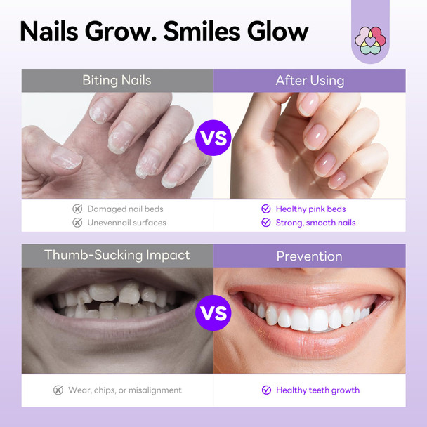 SAVILAND Nail Biting Treatment for Kids Stop Biting Pen: Nail Biting Prevention Thumb Sucking Deterrent Natural Bitter Formula Quick-Dry Anti-Nail Biting for Adults Toddler Children Nail Care Home 5ml