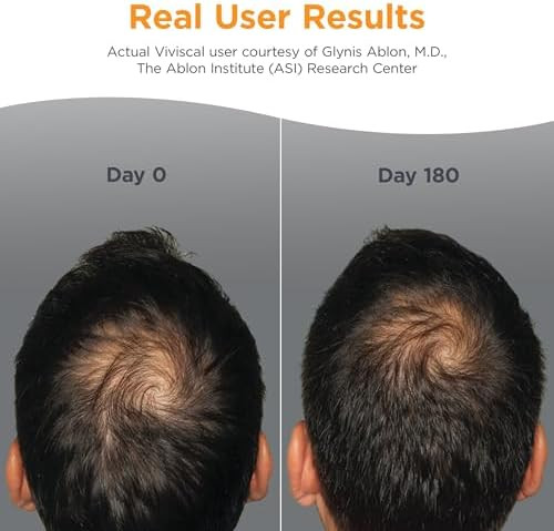 Viviscal Men's Hair Growth Supplements for Thicker Fuller Hair  Clinically Proven Collagen Complex