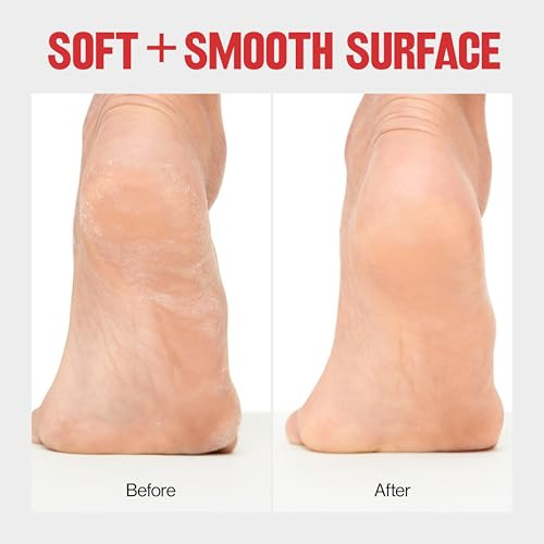 Revlon Callus Remover Foot File For Wet Or Dry Skin Pedicure ToolsGently Pack Of 1