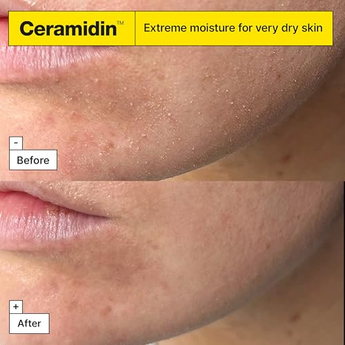 Dr.Jart+ Ceramidin EctoinInfused Korean Face Cream Moisturizer For Dry Skin Korean Skin 1.69 Fl Oz